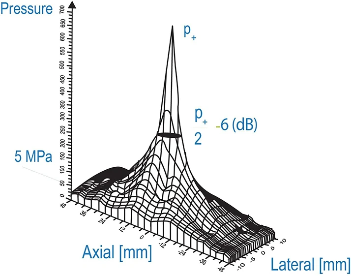 Chiropractic Seabrook TX Softwave Acceleration Graph