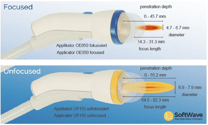 Chiropractic Seabrook TX Softwave Focused vs Unfocused Tool