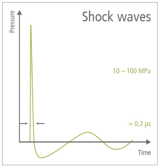 Chiropractic Seabrook TX Softwave Shock Wave Graph